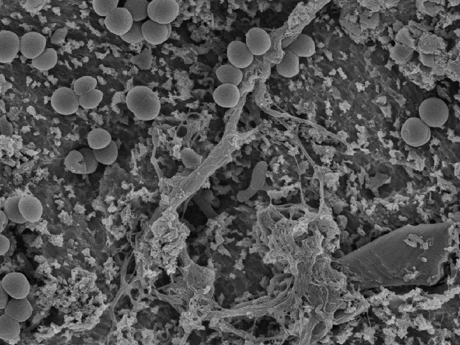 mikroskopbilde av bakterier på en implantatoverflate