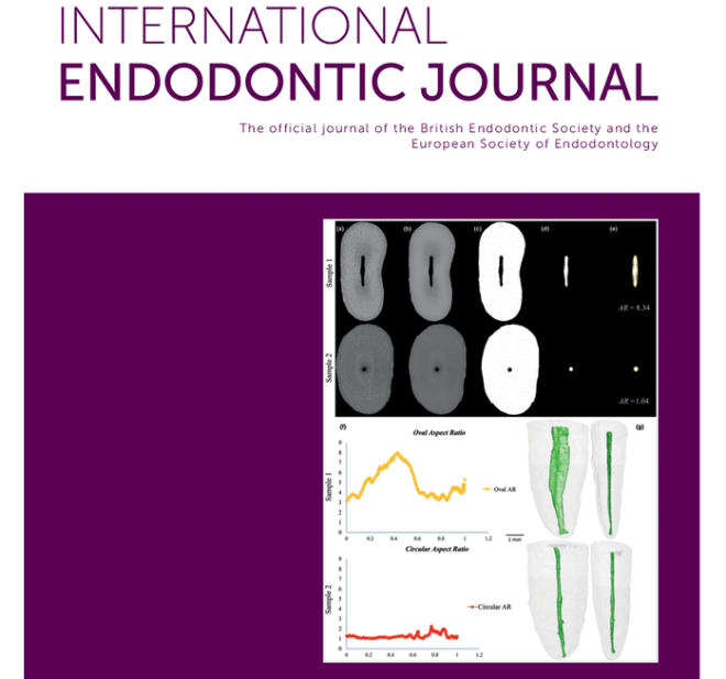Skjermdump av forsiden på International Endodontic Journal