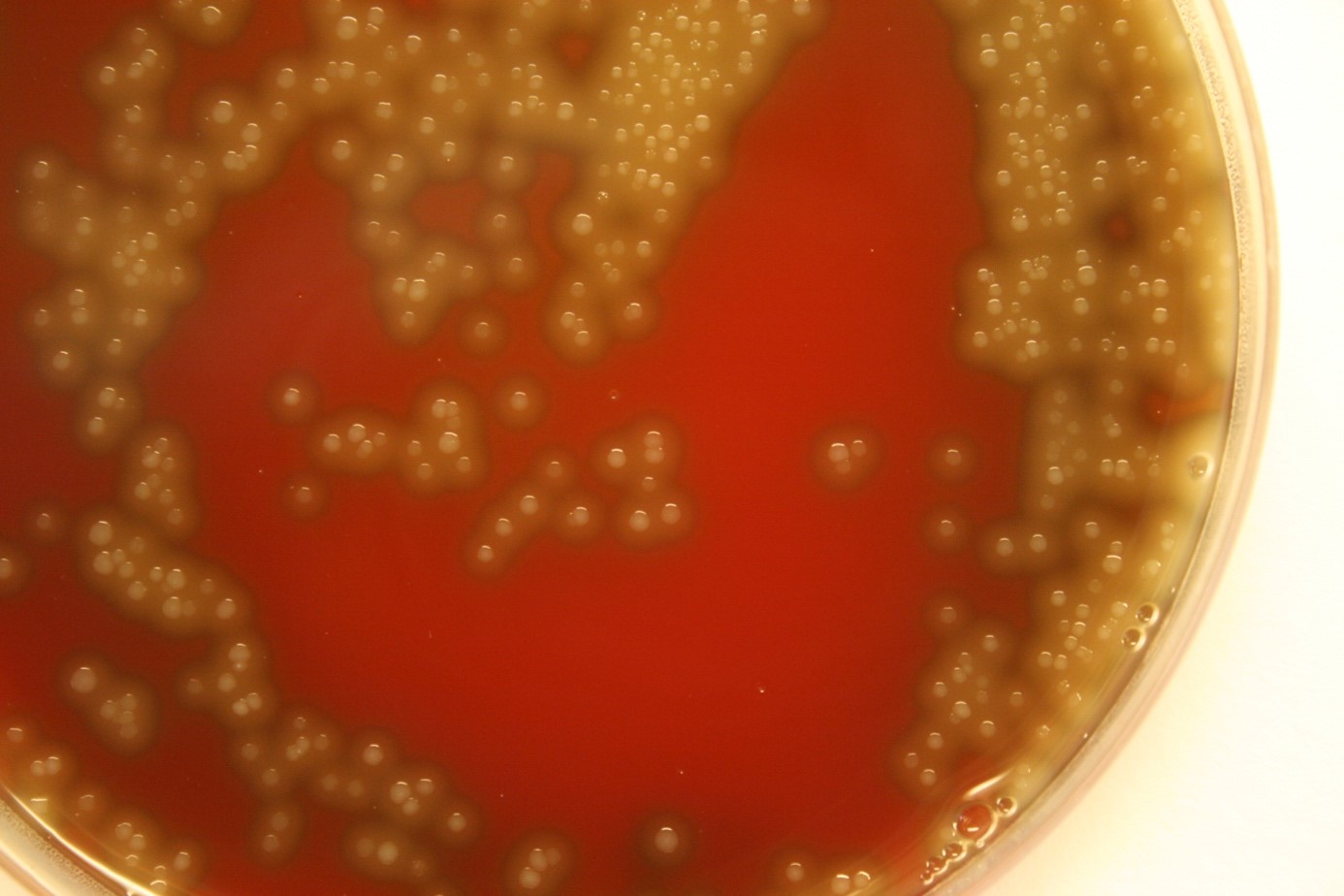 Streptococcus pneumoniae growing in petri dishes in the laboratory.