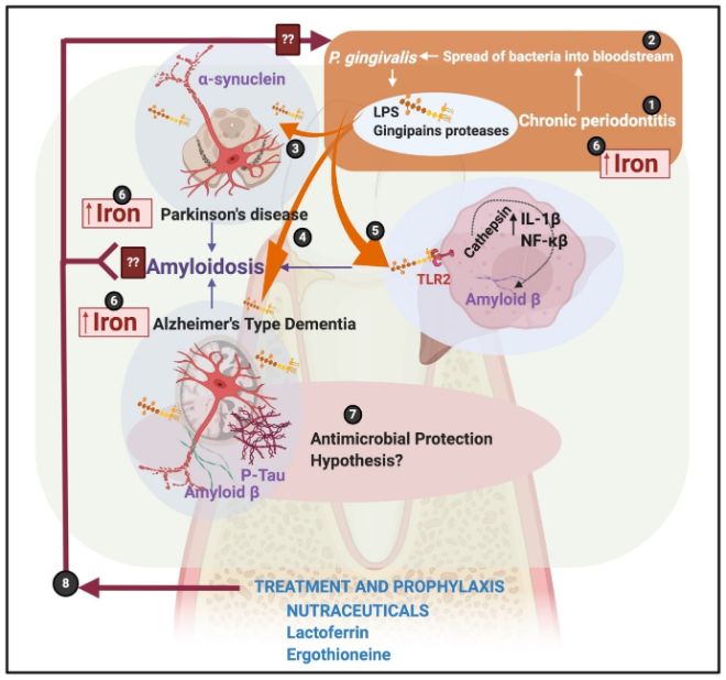 Figur som beskriver mulig forbindelse mellom Porphyromonas gingivalis og Alzheimers og Parkinsons sykdom
