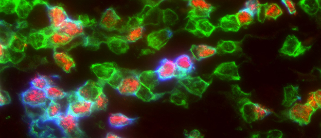T-celler farget i rødt, grønt og blått