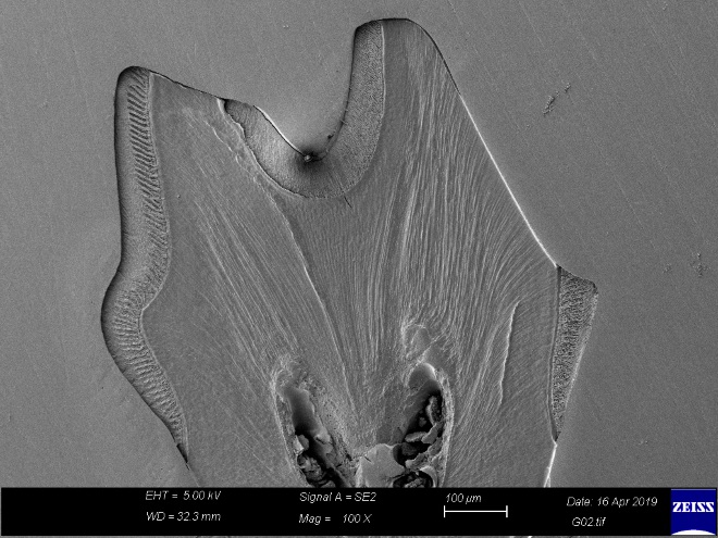 Skanningelektron-mikroskopbilde av tann: Viser at emaljen er etset bort